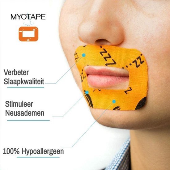Myotape Mondtape 90st Maat L